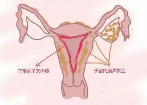 ͼƬ