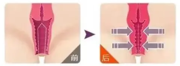 ͼƬ
